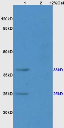 Lane 1: rat brain lysates Lane 2: rat liver lysates probed with Anti CD161 Polyclonal Antibody, Unconjugated (bs-2807R) at 1:200 in 4˚C. Followed by conjugation to secondary antibody (bs-0295G-HRP) at 1:3000 90min in 37˚C. Predicted band 25kD. Observed band size: 25kD, 38kD.