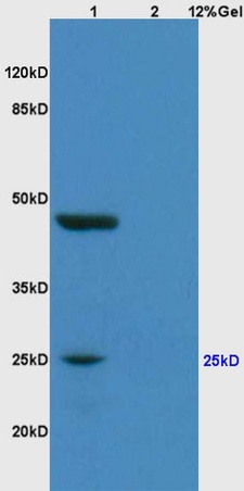 Lane 1: human colon carcinoma lysates Lane 2: rat brain lysates probed with Anti MYOG/Myogenin Polyclonal Antibody, Unconjugated (bs-3550R) at 1:200 in 4˚C. Followed by conjugation to secondary antibody (bs-0295G-HRP) at 1:3000 90min in 37˚C. Predicted band 25kD. Observed band size: 25kD,50kD.