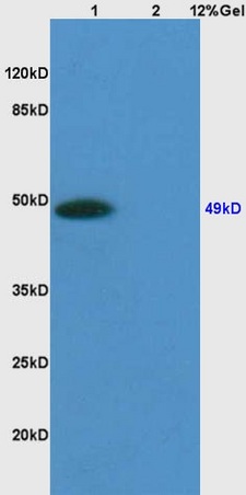 Lane 1: mouse embryo lysates Lane 2: mouse heart lysates probed with Anti Sphingomyelin Synthase 1 Polyclonal Antibody, Unconjugated (bs-4216R) at 1:200 in 4˚C. Followed by conjugation to secondary antibody (bs-0295G-HRP) at 1:3000 90min in 37˚C. Predicted band 49kD. Observed band size: 49kD.