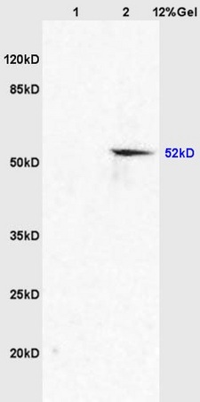 Lane 1: mouse embryo lysates Lane 2: mouse brain lysates probed with Anti AVPR2 Polyclonal Antibody, Unconjugated (bs-4241R) at 1:200 in 4˚C. Followed by conjugation to secondary antibody (bs-0295G-HRP) at 1:3000 90min in 37˚C. Predicted band 52kD. Observed band size: 52kD.