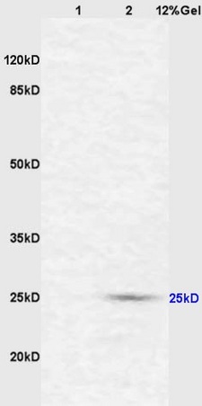 Lane 1: mouse intestine lysates Lane 2: mouse liver lysates probed with Anti CD161c\/NK1.1 Polyclonal Antibody, Unconjugated (bs-4682R) at 1:200 in 4˚C. Followed by conjugation to secondary antibody (bs-0295G-HRP) at 1:3000 90min in 37˚C. Predicted band 25kD. Observed band size: 25kD.