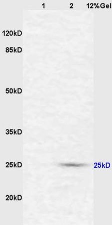 Lane 1: mouse intestine lysates Lane 2: mouse liver lysates probed with Anti CD161c/NK1.1 Polyclonal Antibody, Unconjugated (bs-4682R) at 1:200 in 4˚C. Followed by conjugation to secondary antibody (bs-0295G-HRP) at 1:3000 90min in 37˚C. Predicted band 25kD. Observed band size: 25kD.