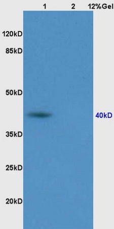 Lane 1: rat muscle lysates Lane 2: rat brain lysates probed with Anti PON1 Polyclonal Antibody, Unconjugated (bs-5107R) at 1:200 in 4˚C. Followed by conjugation to secondary antibody (bs-0295G-HRP) at 1:3000 90min in 37˚C. Predicted band 40kD. Observed band size: 40kD.