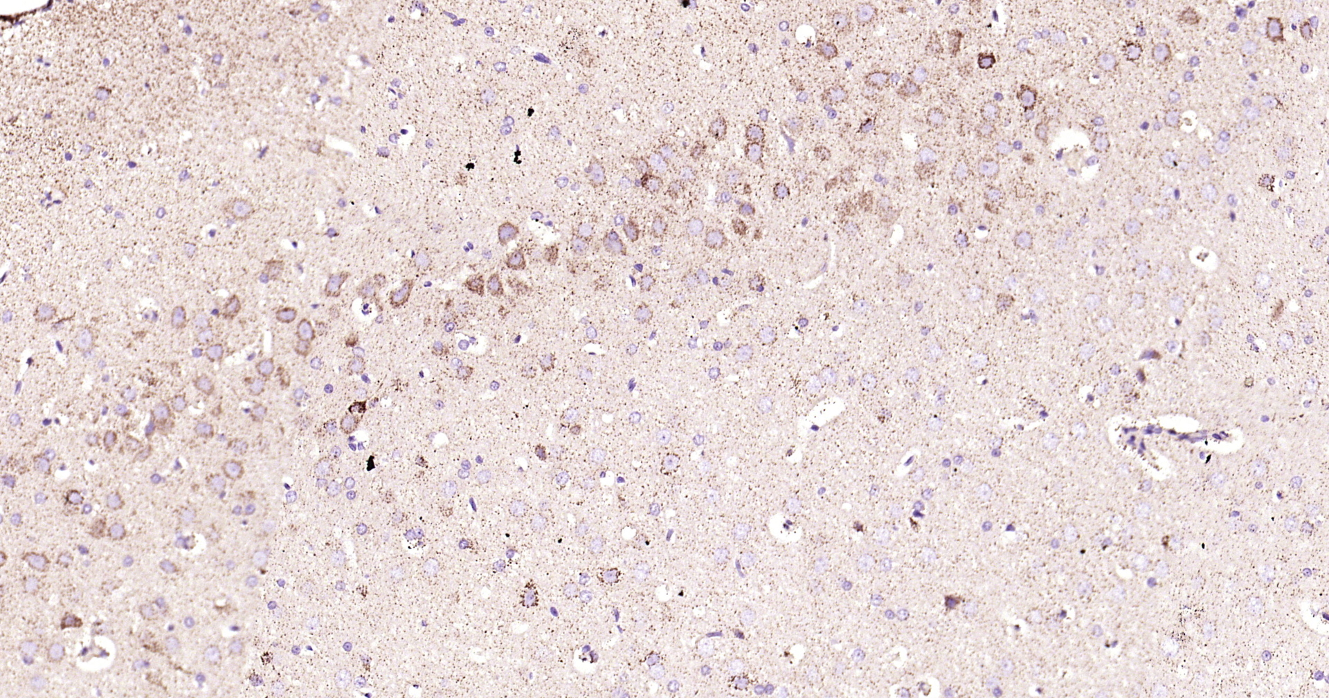ABAT Recombinant Antibody