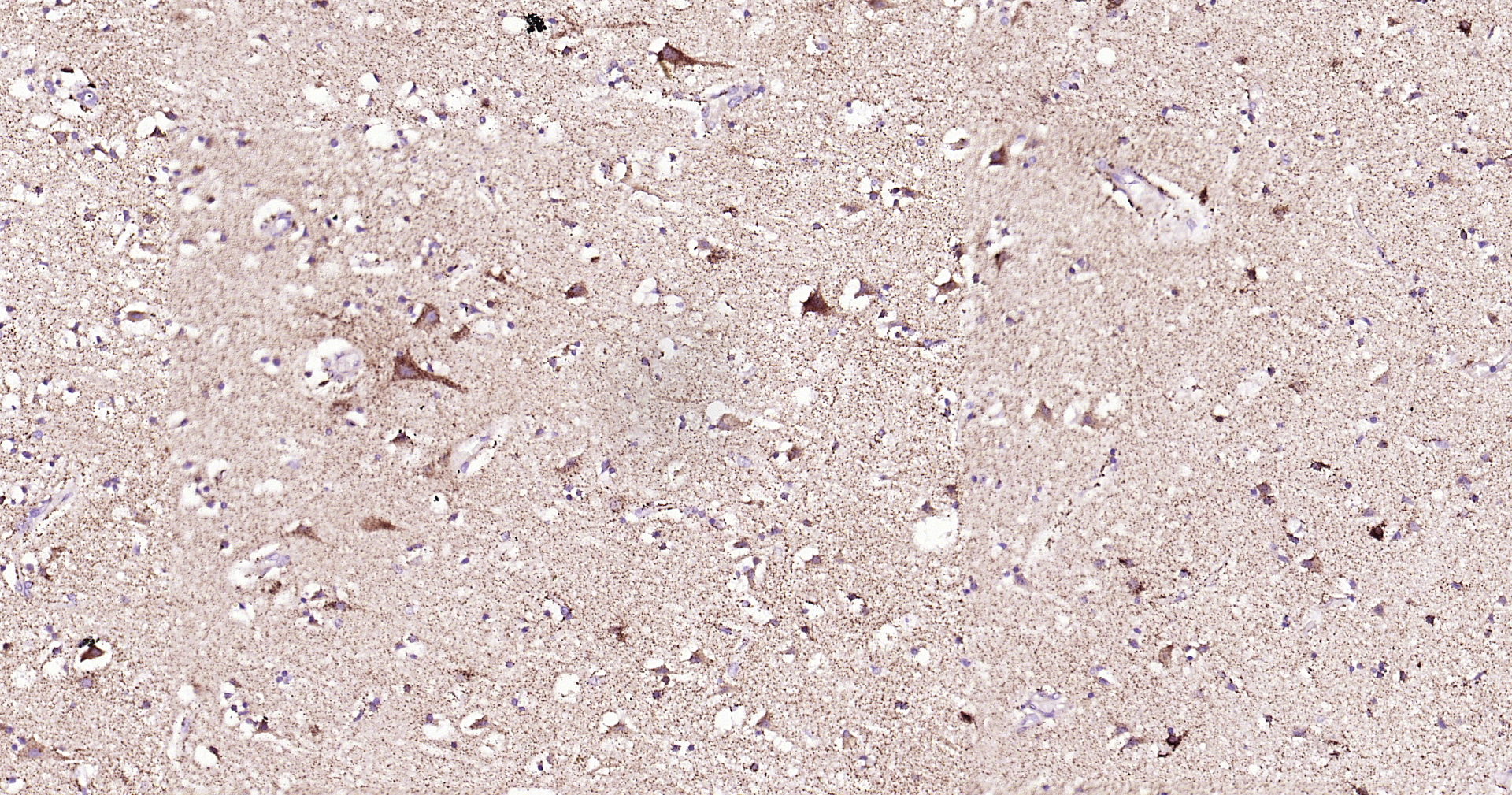 ABAT Recombinant Antibody