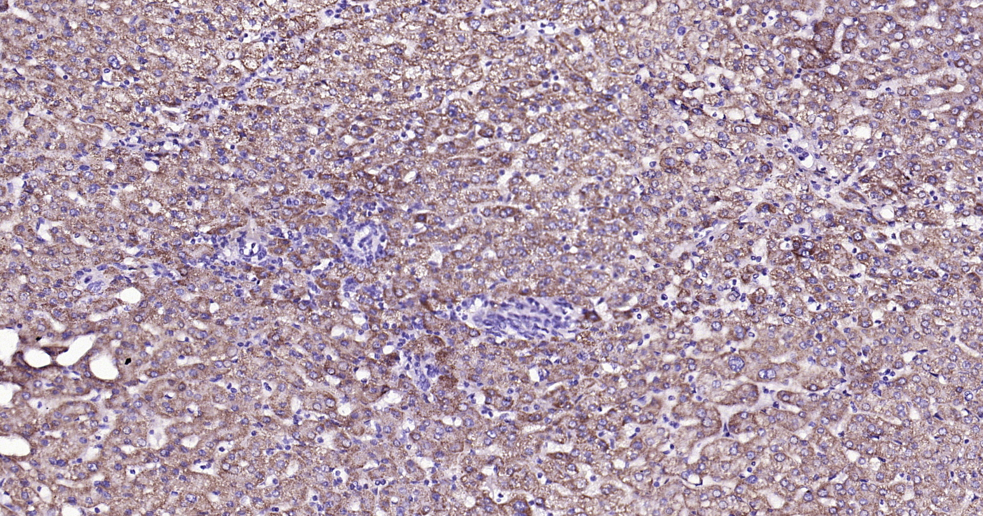 ABAT Recombinant Antibody