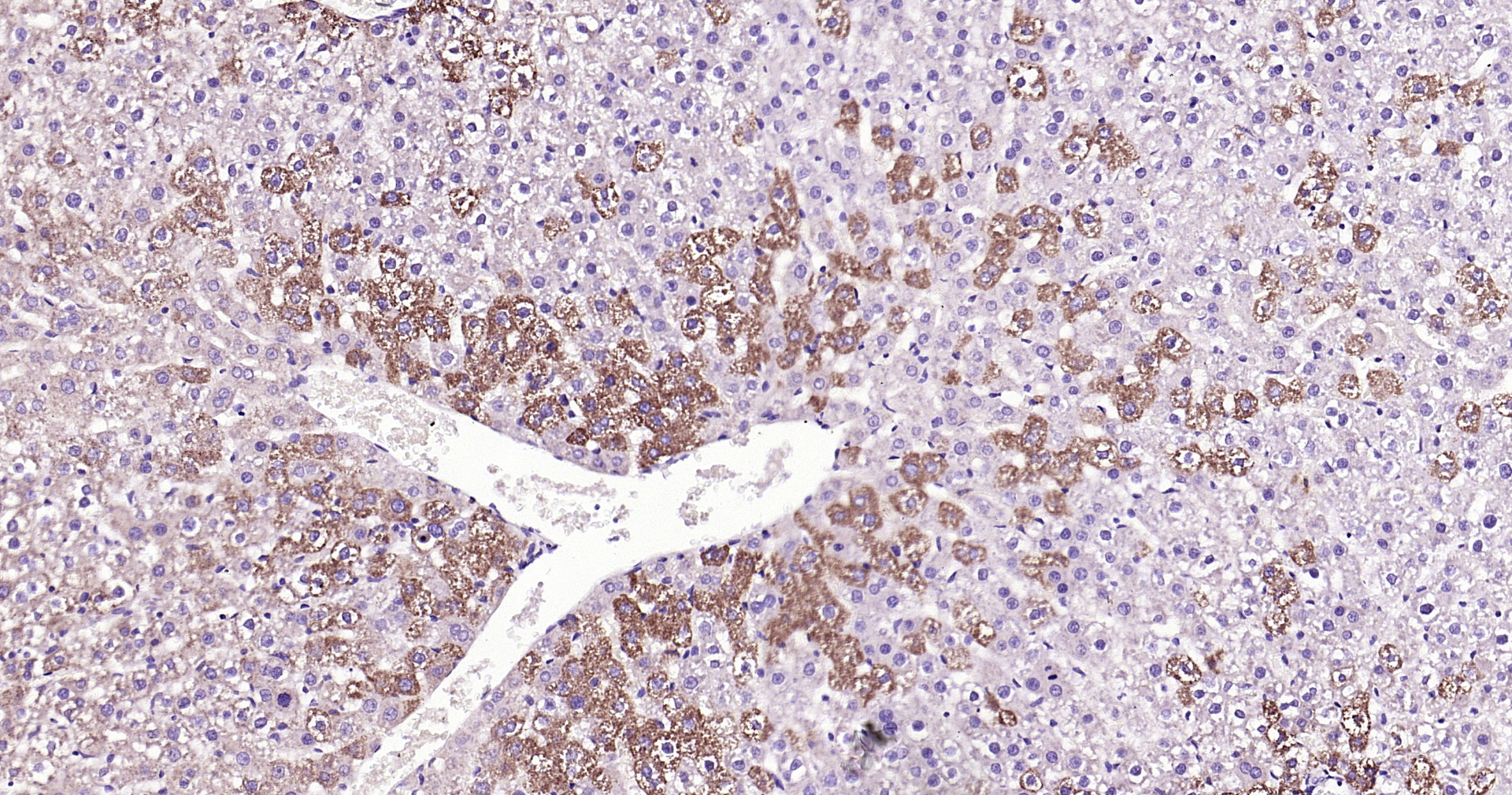 ABAT Recombinant Antibody