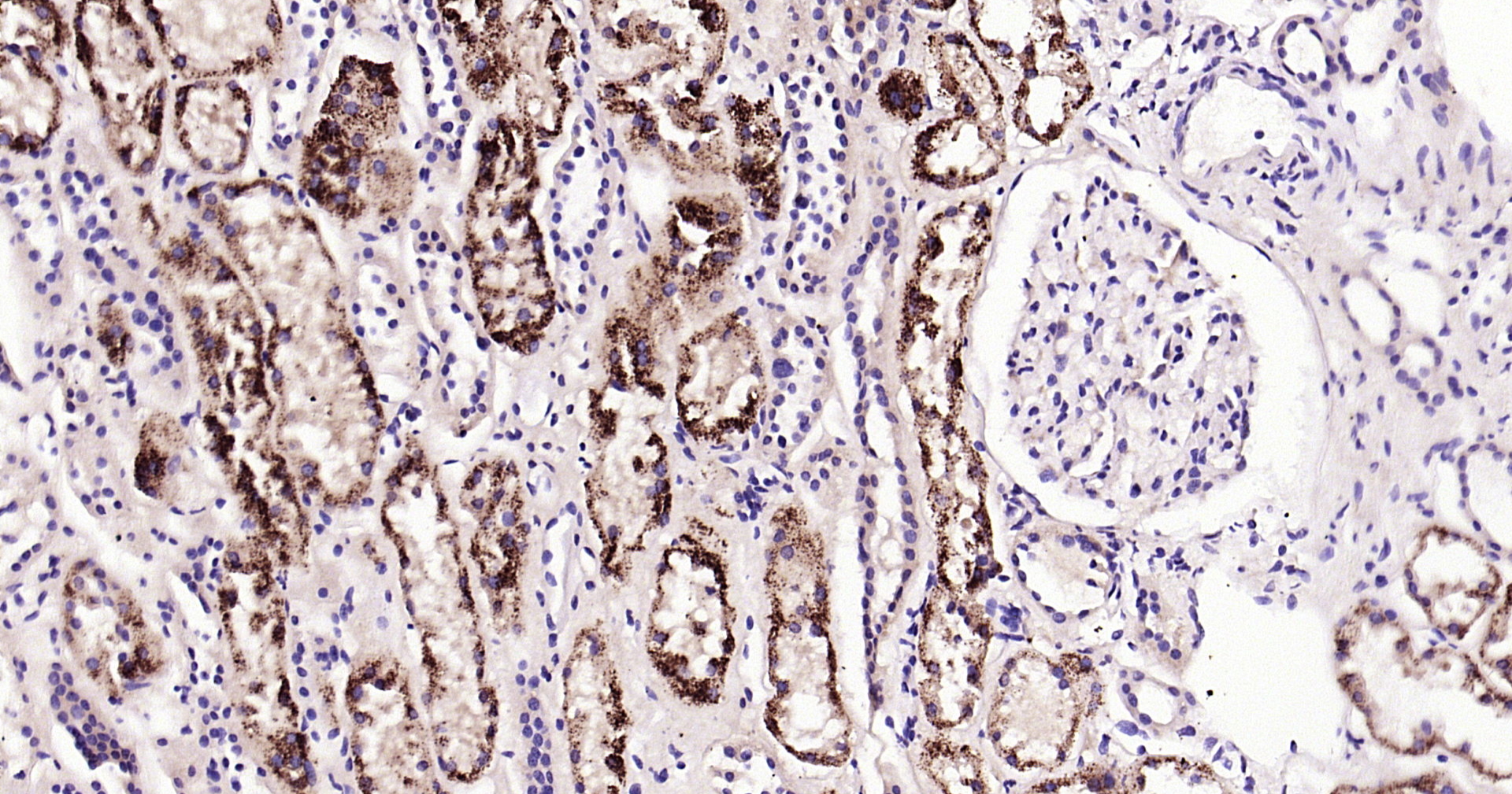 ABAT Recombinant Antibody
