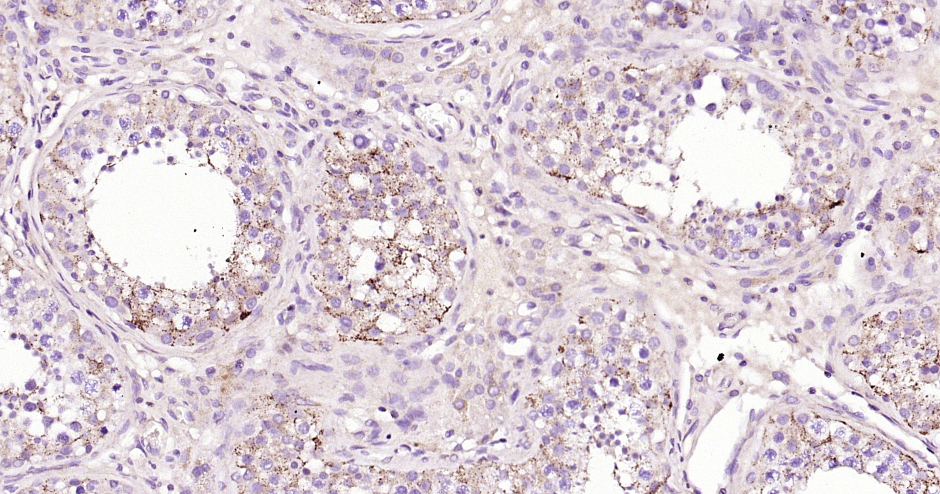 ABAT Recombinant Antibody