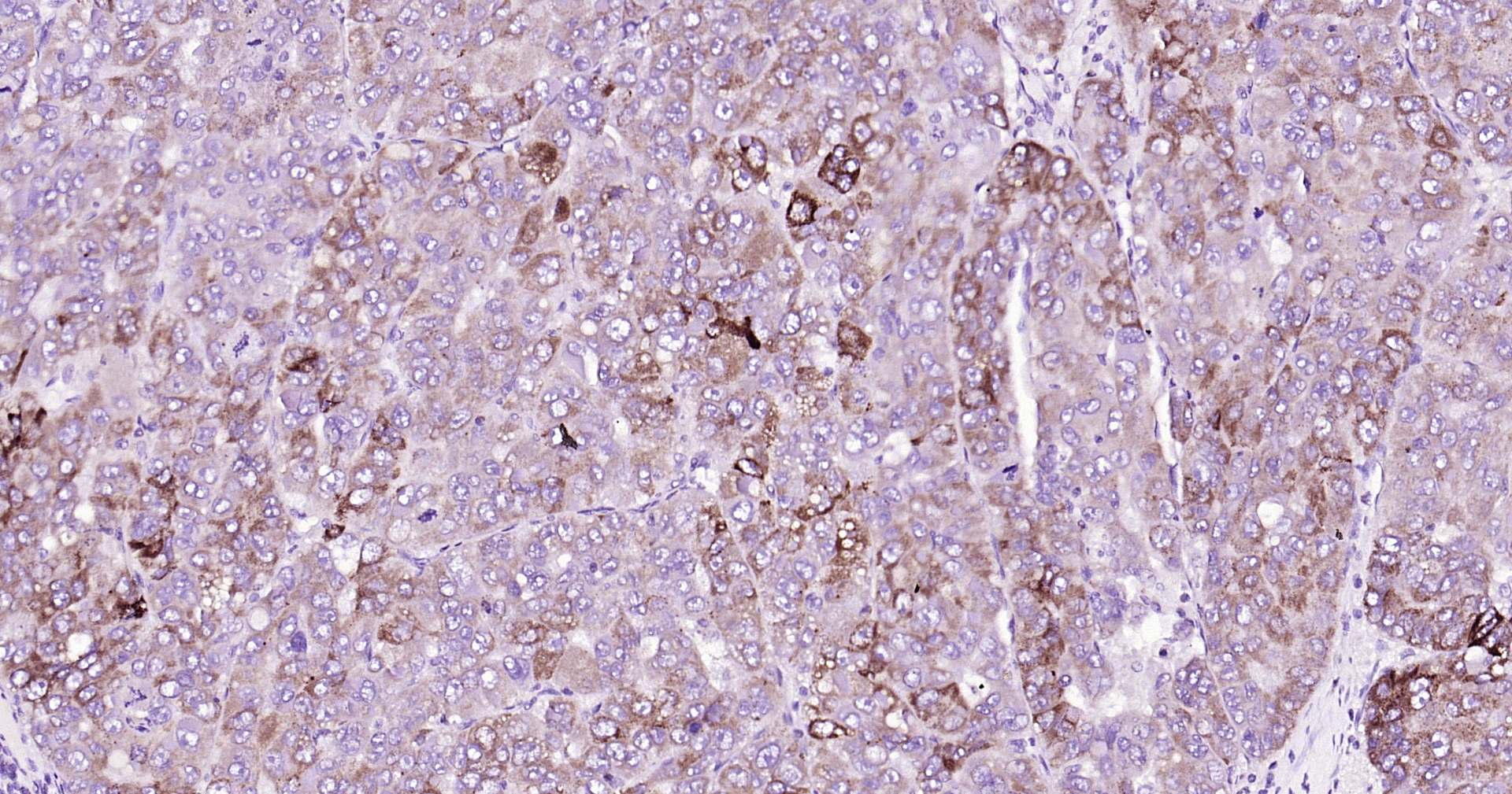 ABAT Recombinant Antibody
