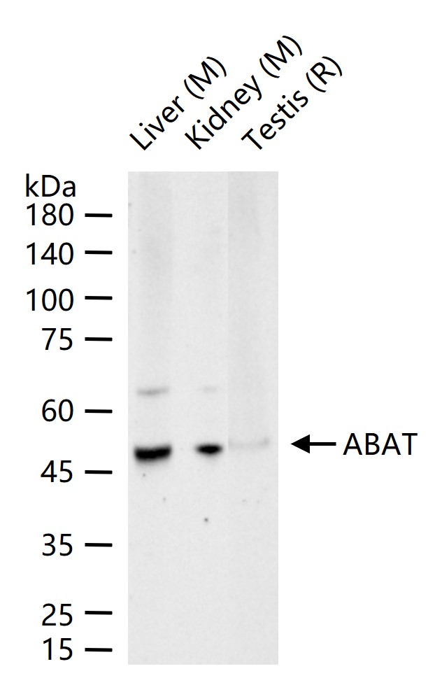 ABAT Recombinant Antibody