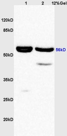 Lane 1: rat liver lysates Lane 2: rat brain lysates probed with Anti phospho-AKT1\/2\/3 (Tyr315\/316\/312) Polyclonal Antibody, Unconjugated (bs-5193R) at 1:200 in 4˚C. Followed by conjugation to secondary antibody (bs-0295G-HRP) at 1:3000 90min in 37˚C. Predicted band 55kD. Observed band size: 55kD.