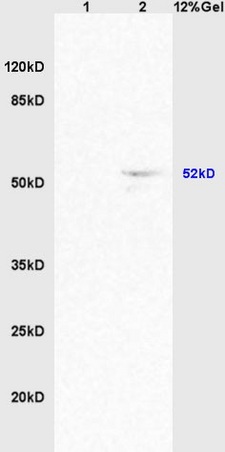 Lane 1: mouse brain lysates Lane 2: mouse heart lysates probed with Anti ACTRIC/Activin A Receptor Type IC Polyclonal Antibody, Unconjugated (bs-5777R) at 1:200 in 4˚C. Followed by conjugation to secondary antibody (bs-0295G-HRP) at 1:3000 90min in 37˚C. Predicted band 52kD. Observed band size: 52kD.