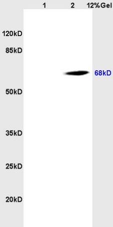 Lane 1: rat brain lysates Lane 2: human colon carcinoma lysates probed with Anti CD98 Polyclonal Antibody, Unconjugated (bs-6659R) at 1:200 in 4˚C. Followed by conjugation to secondary antibody (bs-0295G-HRP) at 1:3000 90min in 37˚C. Predicted band 68kD. Observed band size: 68kD.