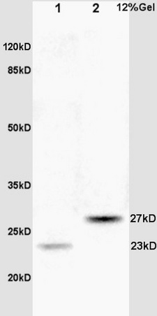 Lane 1: rat brain lysates Lane 2: human colon carcinoma lysates probed with Anti CPSF4/CPSF30 Polyclonal Antibody, Unconjugated (bs-2253R) at 1:200 in 4˚C. Followed by conjugation to secondary antibody (bs-0295G-HRP) at 1:3000 90min in 37˚C. Predicted band 27kD. Observed band size: 23kD, 27kD.