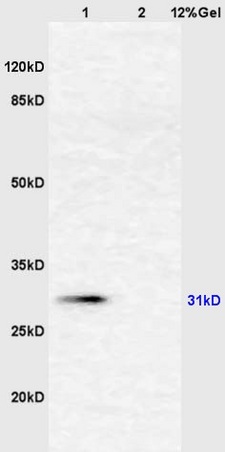 Lane 1: mouse liver lysates Lane 2: mouse intestine lysates probed with Anti AHSG/Fetuin A/Alpha 2 HS Glycoprotein Polyclonal Antibody, Unconjugated (bs-2922R) at 1:200 in 4˚C. Followed by conjugation to secondary antibody (bs-0295G-HRP) at 1:3000 90min in 37˚C. Predicted band 31kD. Observed band size: 31kD.