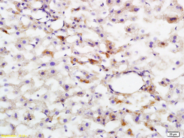 Formalin-fixed and paraffin embedded rat liver tissue labeled with Anti-phospho-HMGCR(Ser872) Polyclonal Antibody, Unconjugated (bs-4063R) at 1:200 followed by conjugation to the secondary antibody and DAB staining