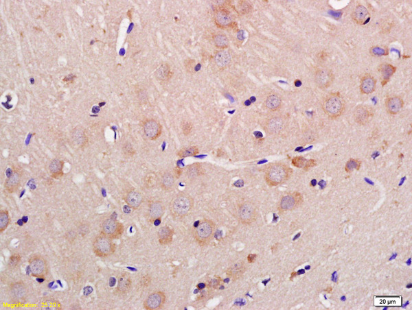 Formalin-fixed and paraffin embedded rat brain labeled with Anti-GLS2/LGA Polyclonal Antibody, Unconjugated (bs-13376R) at 1:200 followed by conjugation to the secondary antibody and DAB staining
