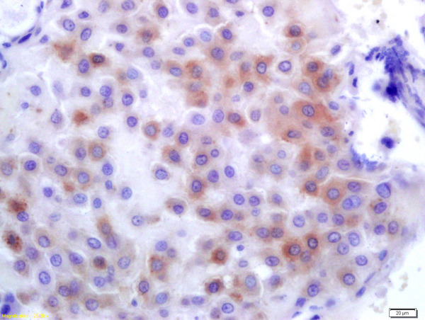 Formalin-fixed and paraffin embedded human placenta labeled with Anti-PLK1 Polyclonal Antibody, Unconjugated (bs-3535R) at 1:200 followed by conjugation to the secondary antibody and DAB staining