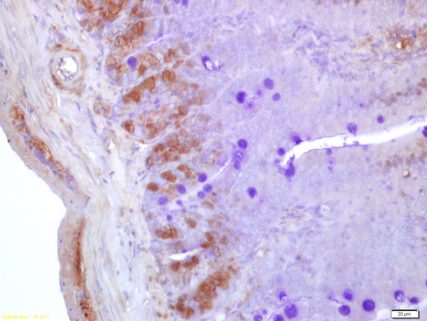 Formalin-fixed and paraffin embedded mouse small intestine labeled with Anti-NGN3/Neurogenin 3 Polyclonal Antibody, Unconjugated (bs-0922R) at 1:200 followed by conjugation to the secondary antibody and DAB staining