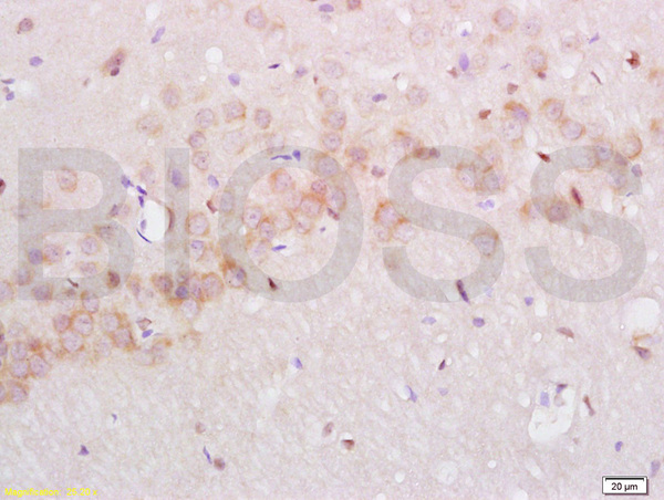 Formalin-fixed and paraffin embedded rat brain labeled with Anti-NGFR\/p75NTR Polyclonal Antibody, Unconjugated (bs-0161R) at 1:200 followed by conjugation to the secondary antibody and DAB staining