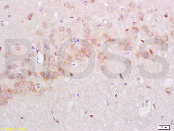 Formalin-fixed and paraffin embedded rat brain labeled with Anti-NGFR/p75NTR Polyclonal Antibody, Unconjugated (bs-0161R) at 1:200 followed by conjugation to the secondary antibody and DAB staining