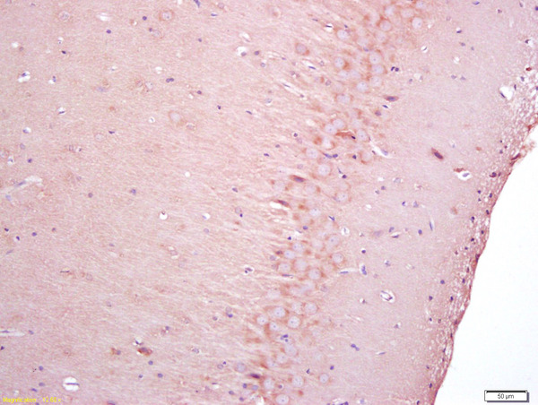 Formalin-fixed and paraffin embedded rat brain labeled with Anti-NGFR\/p75NTR Polyclonal Antibody, Unconjugated (bs-7122R) at 1:200 followed by conjugation to the secondary antibody and DAB staining