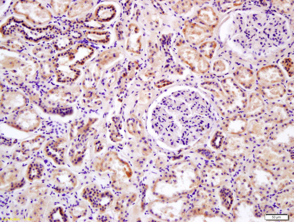 Formalin-fixed and paraffin embedded human kidney labeled with Anti-DDIT4L Polyclonal Antibody, Unconjugated (bs-6376R) at 1:200 followed by conjugation to the secondary antibody and DAB staining