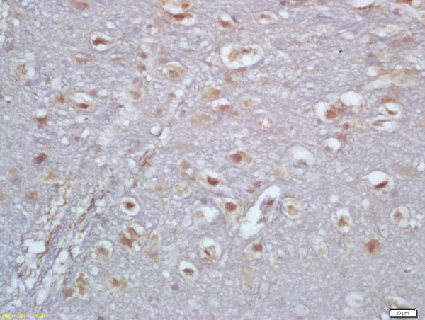 Formalin-fixed and paraffin embedded rat brain labeled with Anti-TBX6 Polyclonal Antibody, Unconjugated (bs-12281R) at 1:200 followed by conjugation to the secondary antibody and DAB staining