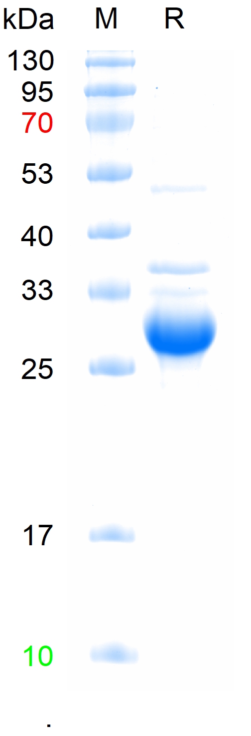 Recombinant Human LGR5 Protein, N-His