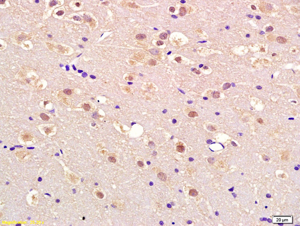 Formalin-fixed and paraffin embedded rat brain labeled with Anti-APEX2 Polyclonal Antibody, Unconjugated (bs-6587R) at 1:200 followed by conjugation to the secondary antibody and DAB staining