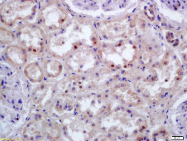 Formalin-fixed and paraffin embedded human kidney labeled with Anti-HOXC9 Polyclonal Antibody, Unconjugated (bs-7982R) at 1:200 followed by conjugation to the secondary antibody and DAB staining