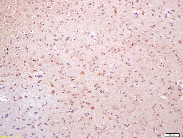 Formalin-fixed and paraffin embedded rat brain labeled with Anti-Phospho-TAK1(Thr184)Polyclonal Antibody, Unconjugated (bs-3436R) at 1:200 followed by conjugation to the secondary antibody and DAB staining