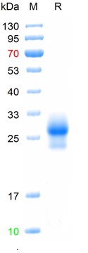 Recombinant Human Thy-1 protein, C-His (HEK293)