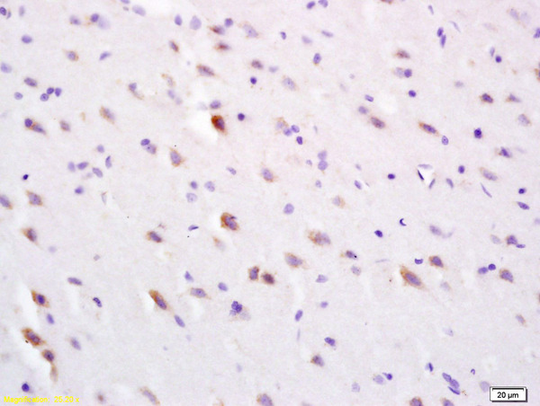 Formalin-fixed and paraffin embedded rat brain labeled with Anti-SLC30A3/ZNT3 Polyclonal Antibody, Unconjugated (bs-8717R) at 1:200 followed by conjugation to the secondary antibody and DAB staining
