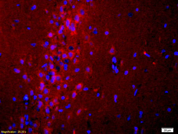 Formalin-fixed and paraffin-embedded rat brain labeled with Anti ADCY10 Polyclonal Antibody, Unconjugated(bs-3916R) 1:200, overnight at 4°C, The secondary antibody was Goat Anti-Rabbit IgG, Cy3 conjugated(bs-0295G-Cy3)used at 1:200 dilution for 40 minutes at 37°C.