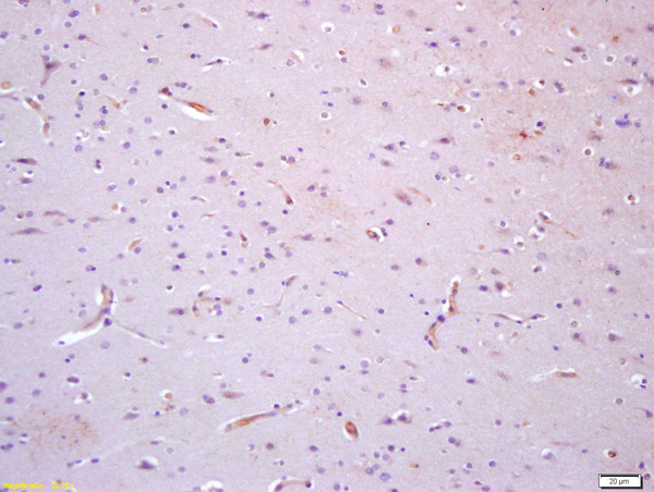 Formalin-fixed and paraffin embedded human brain with labeled Anti-TIE1 Polyclonal Antibody, Unconjugated (bs-1334R) at 1:200, followed by conjugation to the secondary antibody and DAB staining