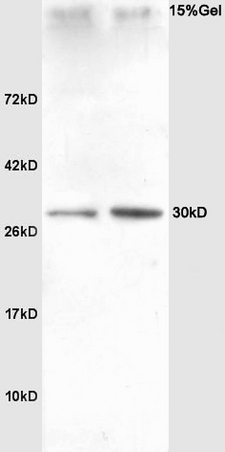 Lane 1: rat heart Lane 2: rat liver lysates probed with Anti SNAI2/SLUG Polyclonal Antibody, Unconjugated (bs-1382R) at 1:200 in 4˚C. Followed by conjugation to secondary antibody (bs-0295G-HRP) at 1:3000 90min in 37˚C. Predicted band 30kD. Observed band size: 30kD.