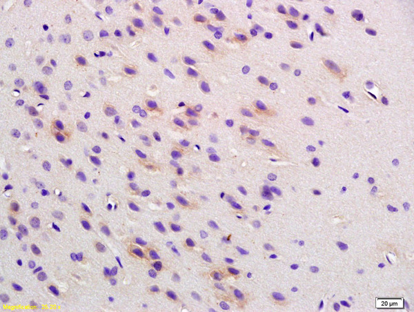 Formalin-fixed and paraffin embedded rat brain labeled with Anti Phospho-Cofilin (Ser3) Polyclonal Antibody (bs-3099R), Unconjugated at 1:200, followed by conjugation to the secondary antibody and DAB staining