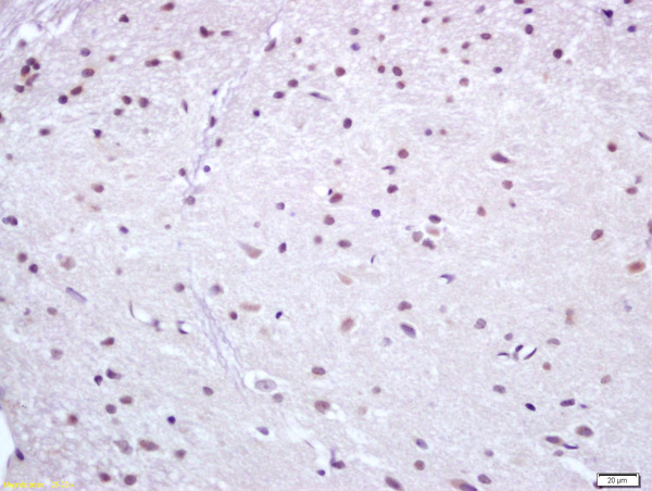 Formalin-fixed and paraffin embedded rat brain labeled with Anti Nur77 Polyclonal Antibody (bs-3513R), Unconjugated at 1:200, followed by conjugation to the secondary antibody and DAB staining