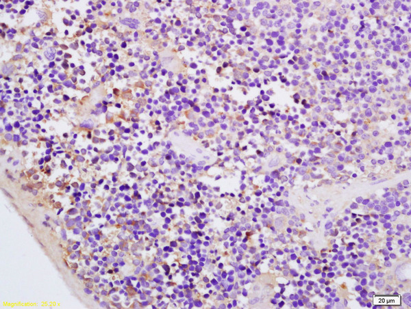 Formalin-fixed and paraffin embedded rat spleen labeled with Rabbit Anti CMKLR1 Polyclonal Antibody, Unconjugated (bs-12478R) at 1:200 followed by conjugation to the secondary antibody and DAB staining