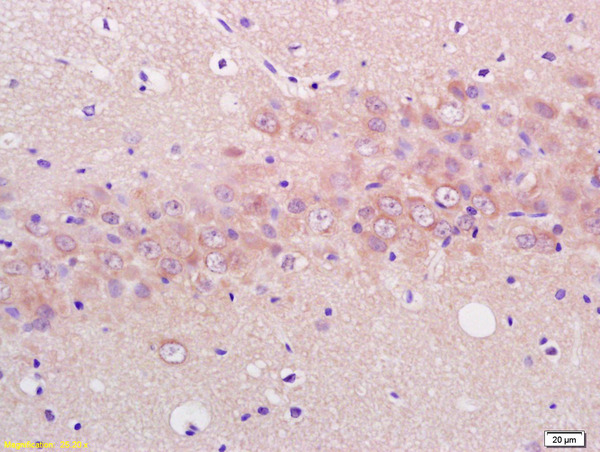 Formalin-fixed and paraffin embedded rat brain labeled with Anti ENO3 Polyclonal Antibody (bs-3979R), Unconjugated at 1:200, followed by conjugation to the secondary antibody and DAB staining