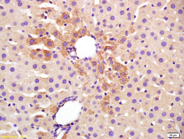 Formalin-fixed and paraffin embedded rat liver labeled with Anti TGM2 Polyclonal Antibody (bs-6196R), Unconjugated at 1:200, followed by conjugation to the secondary antibody and DAB staining