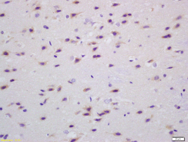 Formalin-fixed and paraffin embedded rat brain labeled with Anti Transglutaminase Polyclonal Antibody (bs-6690R), Unconjugated at 1:200, followed by conjugation to the secondary antibody and DAB staining