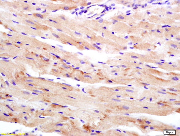 Formalin-fixed and paraffin embedded rat heart labeled with Anti-WDR26 Polyclonal Antibody, Unconjugated (bs-0932R) at 1:200 followed by conjugation to the secondary antibody and DAB staining
