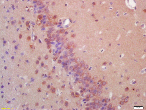 Formalin-fixed and paraffin embedded rat brain labeled with Anti-EIF2AK2/PKR Polyclonal Antibody, Unconjugated (bs-1493R) at 1:200 followed by conjugation to the secondary antibody and DAB staining