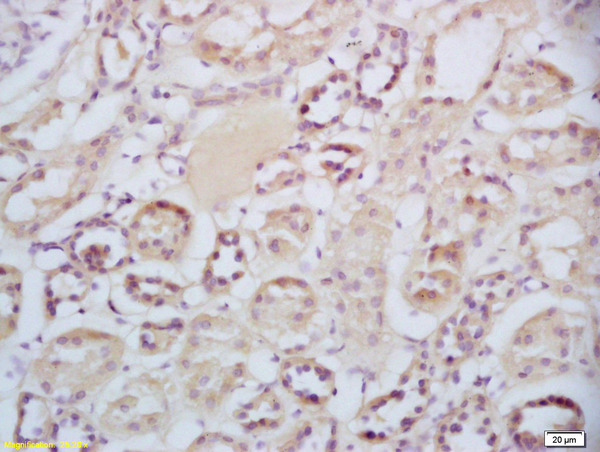 Formalin-fixed and paraffin embedded human kidney labeled with Rabbit Anti-Sclerostin Polyclonal Antibody, Unconjugated(bs-10200R) at 1:200 followed by conjugation to the secondary antibody and DAB staining