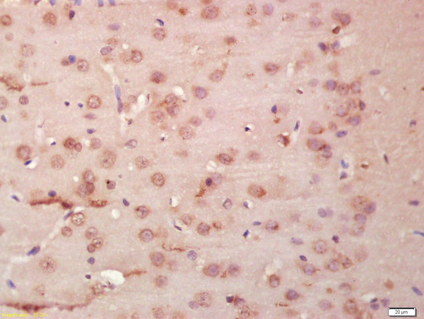 Formalin-fixed and paraffin embedded rat brain labeled with Anti-tubulin Beta Polyclonal Antibody, Unconjugated (bs-4511R) at 1:200 followed by conjugation to the secondary antibody and DAB staining