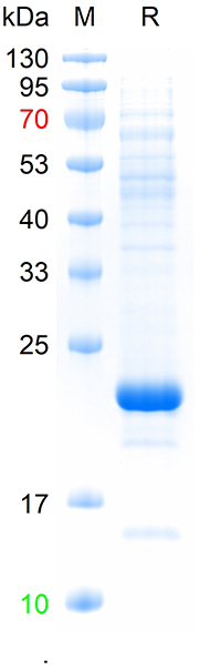 Recombinant  mouse NPHS2 protein