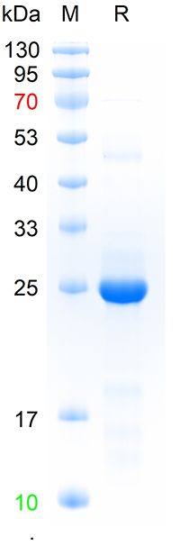 Recombinant  human ADAMTS5 protein